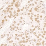 Immunohistochemistry - Anti-TLS / FUS Antibody (A301797) - Antibodies.com