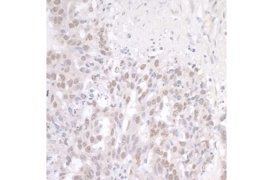 Immunohistochemistry - Anti-TLS / FUS Antibody (A301797) - Antibodies.com