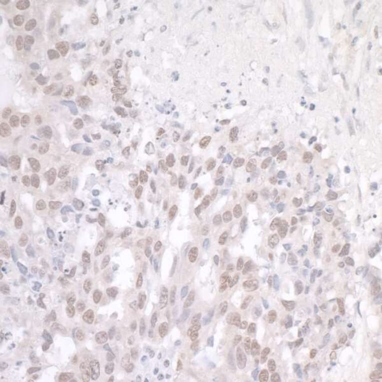 Immunohistochemistry - Anti-TLS / FUS Antibody (A301797) - Antibodies.com