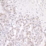 Immunohistochemistry - Anti-TLS / FUS Antibody (A301797) - Antibodies.com