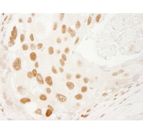 Immunohistochemistry - Anti-PML Antibody (A301945) - Antibodies.com