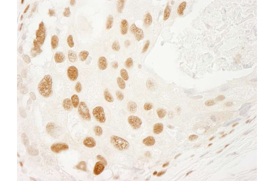Immunohistochemistry - Anti-PML Antibody (A301945) - Antibodies.com