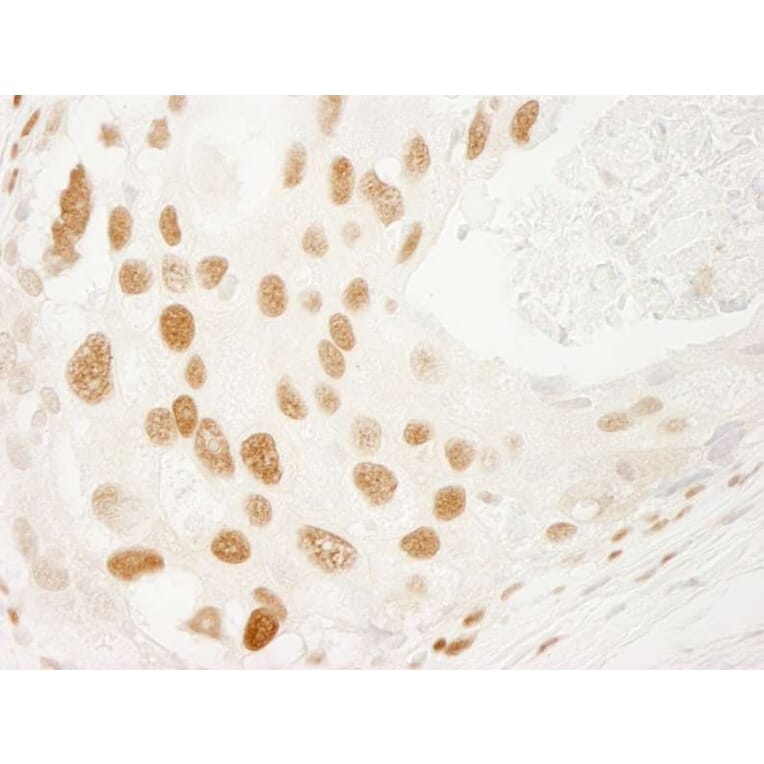 Immunohistochemistry - Anti-PML Antibody (A301945) - Antibodies.com