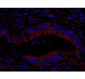 Immunohistochemistry- Anti-CIP2A Antibody (A301968) - Antibodies.com