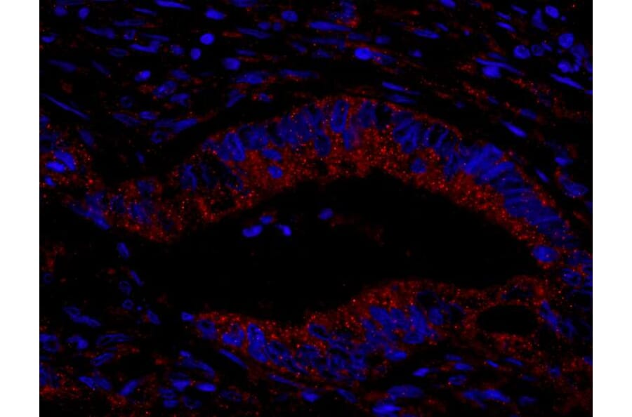 Immunohistochemistry- Anti-CIP2A Antibody (A301968) - Antibodies.com