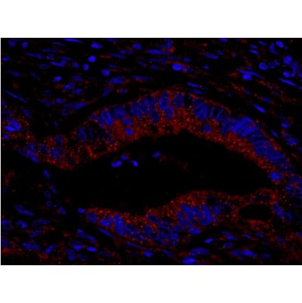 Immunohistochemistry- Anti-CIP2A Antibody (A301968) - Antibodies.com