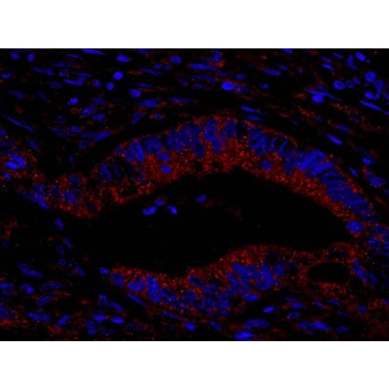 Immunohistochemistry- Anti-CIP2A Antibody (A301968) - Antibodies.com