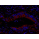 Immunohistochemistry- Anti-CIP2A Antibody (A301968) - Antibodies.com