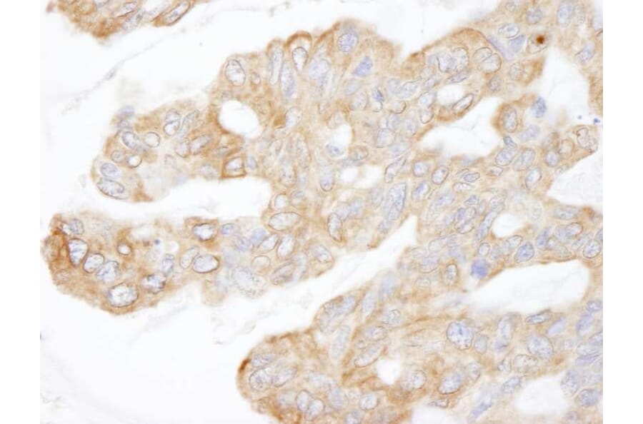 Immunohistochemistry - Anti-CIP2A Antibody (A301968) - Antibodies.com