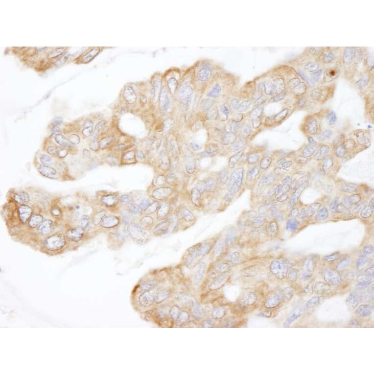 Immunohistochemistry - Anti-CIP2A Antibody (A301968) - Antibodies.com