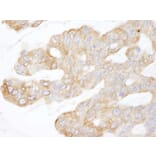 Immunohistochemistry - Anti-CIP2A Antibody (A301968) - Antibodies.com