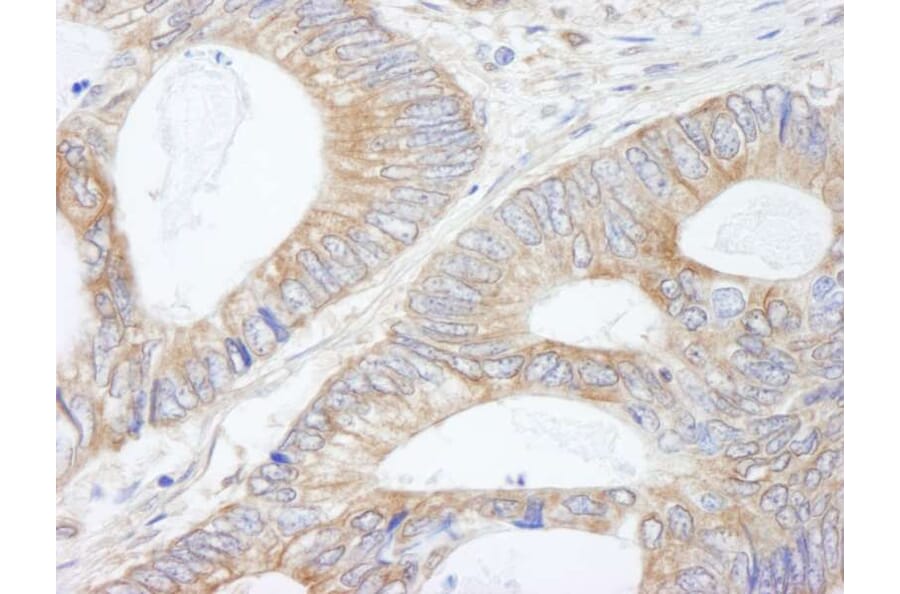 Immunohistochemistry - Anti-CIP2A Antibody (A301968) - Antibodies.com