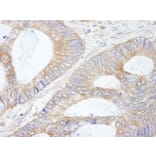 Immunohistochemistry - Anti-CIP2A Antibody (A301968) - Antibodies.com