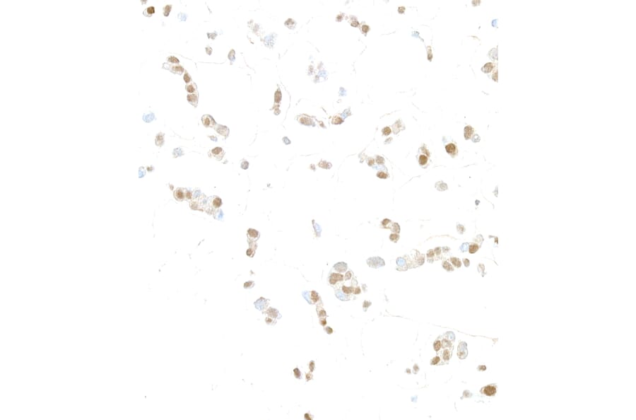 Immunohistochemistry- Anti-HIF-1 alpha Antibody (A302135) - Antibodies.com