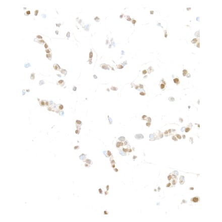 Immunohistochemistry- Anti-HIF-1 alpha Antibody (A302135) - Antibodies.com