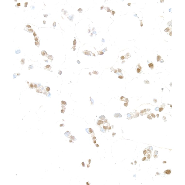 Immunohistochemistry- Anti-HIF-1 alpha Antibody (A302135) - Antibodies.com