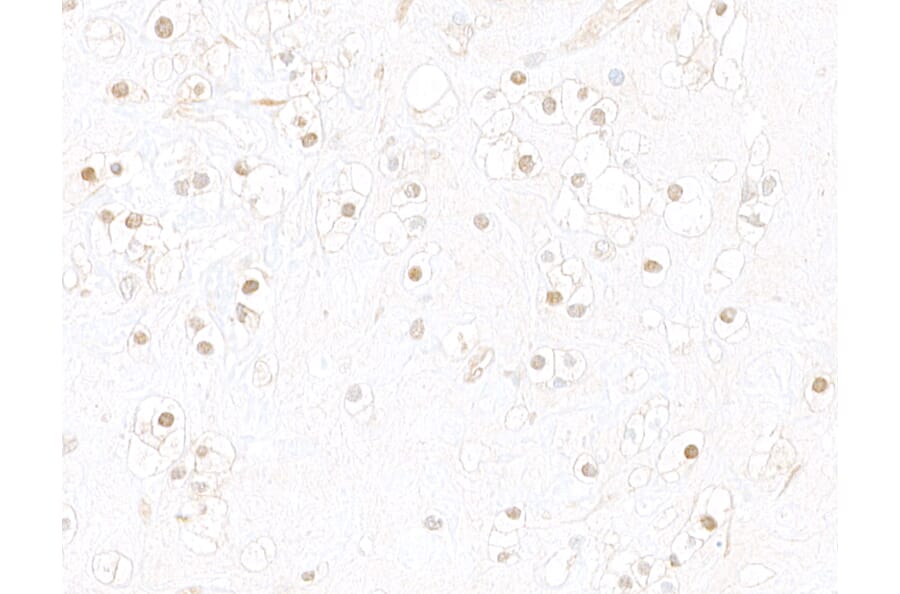 Immunohistochemistry - Anti-HIF-1 alpha Antibody (A302135) - Antibodies.com
