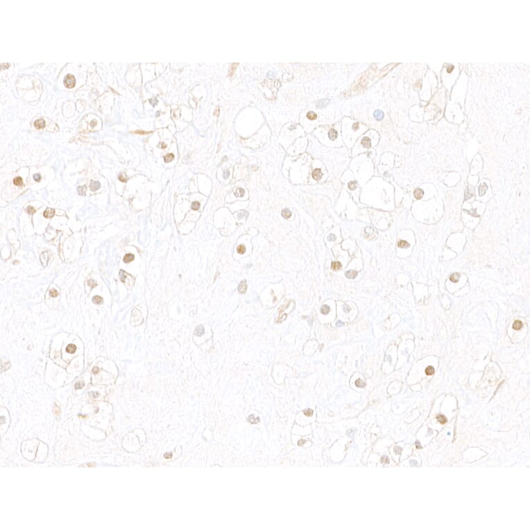 Immunohistochemistry - Anti-HIF-1 alpha Antibody (A302135) - Antibodies.com