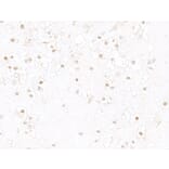 Immunohistochemistry - Anti-HIF-1 alpha Antibody (A302135) - Antibodies.com