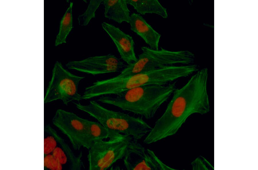 Immunocytochemistry - Anti-HIF-1 alpha Antibody (A302135) - Antibodies.com