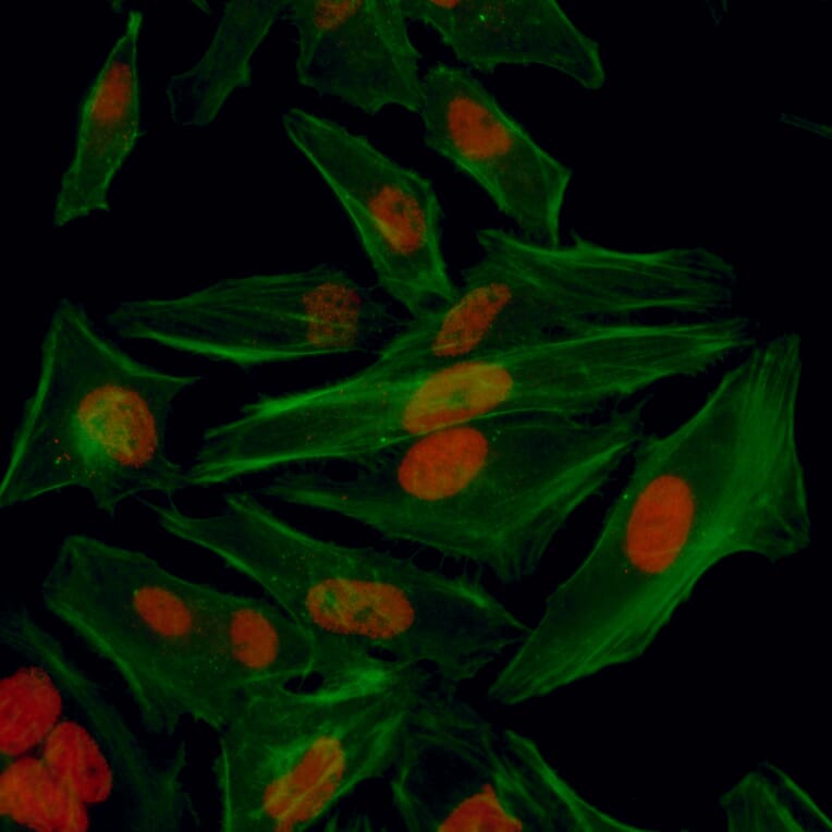 Immunocytochemistry - Anti-HIF-1 alpha Antibody (A302135) - Antibodies.com