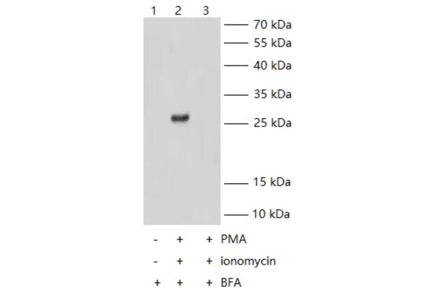 IFN gamma KO Validation - Human IFN gamma ELISA Kit (Ultra High Sensitivity) (A302527) - Antibodies.com