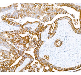 Immunohistochemistry - Anti-Cytokeratin Antibody [AE1/AE3] - BSA free (A304135) - Antibodies.com