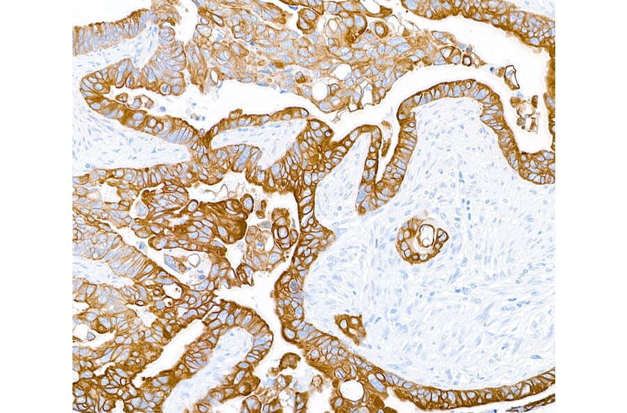 Immunohistochemistry - Anti-Cytokeratin Antibody [AE1/AE3] - BSA free (A304135) - Antibodies.com