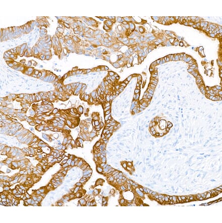 Immunohistochemistry - Anti-Cytokeratin Antibody [AE1/AE3] - BSA free (A304135) - Antibodies.com