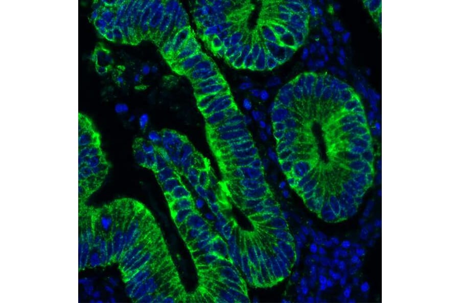 Immunohistochemistry - Anti-Cytokeratin Antibody [AE1/AE3] - BSA free (A304135) - Antibodies.com