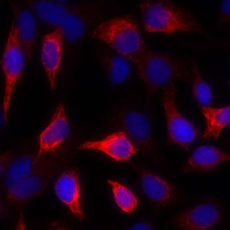 Immunocytochemistry - Anti-Cytokeratin Antibody [AE1/AE3] - BSA free (A304135) - Antibodies.com