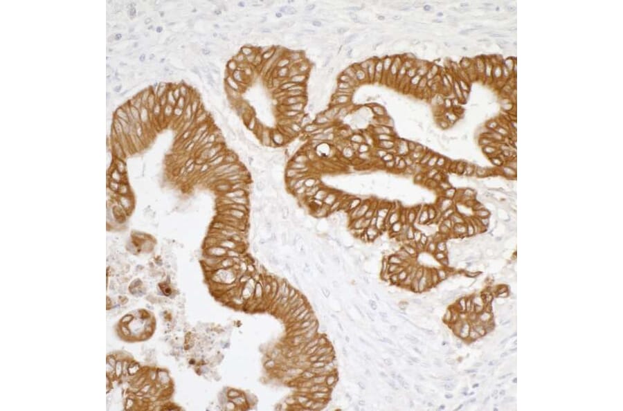 Immunohistochemistry- Anti-Cytokeratin Antibody [AE1/AE3] - BSA free (A304135) - Antibodies.com