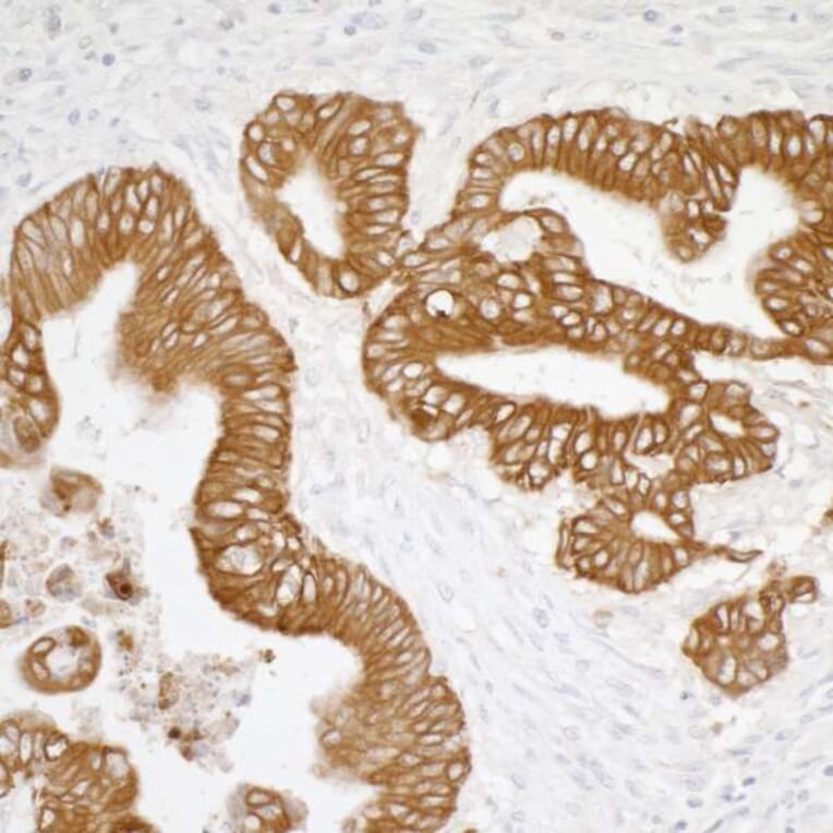 Immunohistochemistry- Anti-Cytokeratin Antibody [AE1/AE3] - BSA free (A304135) - Antibodies.com