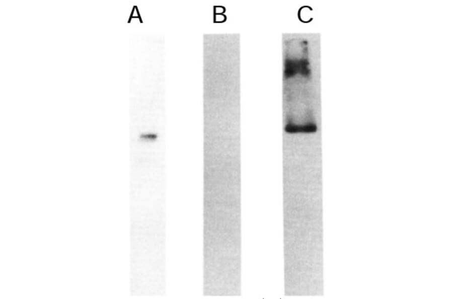 Validation Data - Anti-High MW Kininogen Light Chain Antibody [C11C1] - BSA and Azide free (A304204)
