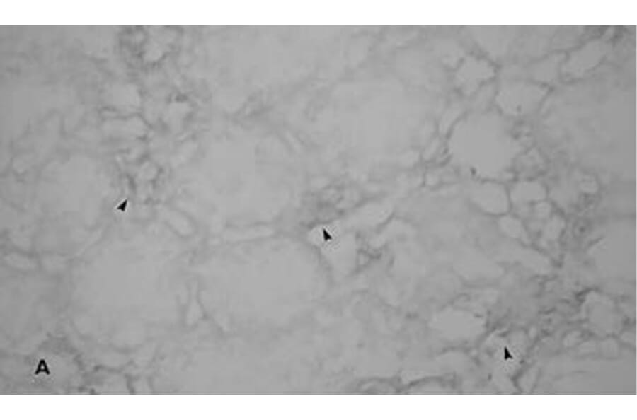 Validation Data - Anti-Endothelin-1 Antibody [ENDO20-2101.70] - BSA and Azide free (A304208)