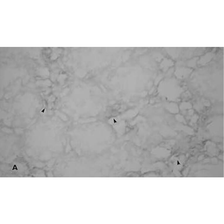 Validation Data - Anti-Endothelin-1 Antibody [ENDO20-2101.70] - BSA and Azide free (A304208)