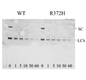 Validation Data - Anti-Factor VIII Antibody [F827.4] - BSA and Azide free (A304225)