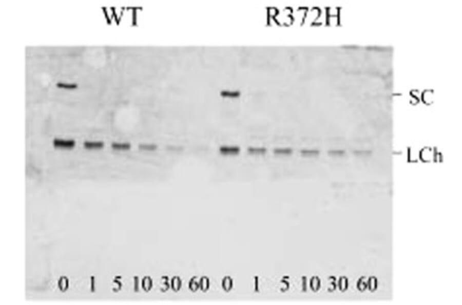 Validation Data - Anti-Factor VIII Antibody [F827.4] - BSA and Azide free (A304225)