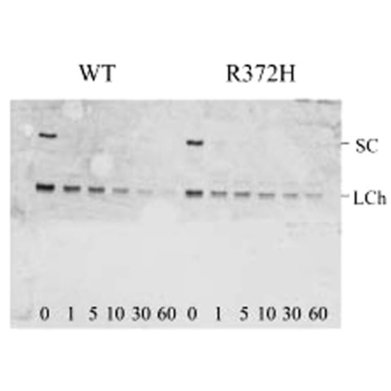 Validation Data - Anti-Factor VIII Antibody [F827.4] - BSA and Azide free (A304225)