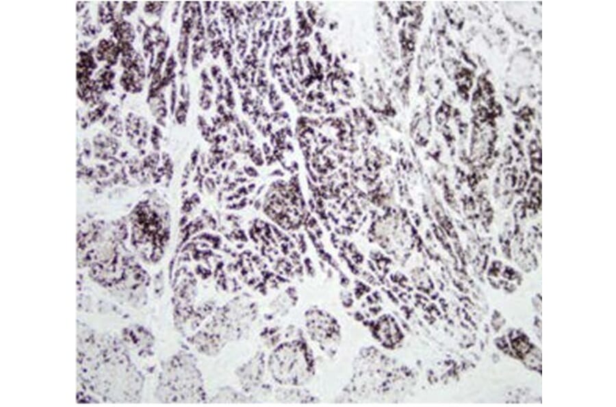 Validation Data - Anti-Chymotrypsin Antibody [CHY10-104.10] - BSA and Azide free (A304255)