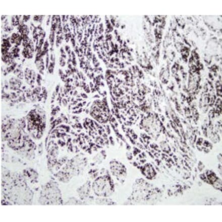 Validation Data - Anti-Chymotrypsin Antibody [CHY10-104.10] - BSA and Azide free (A304255)