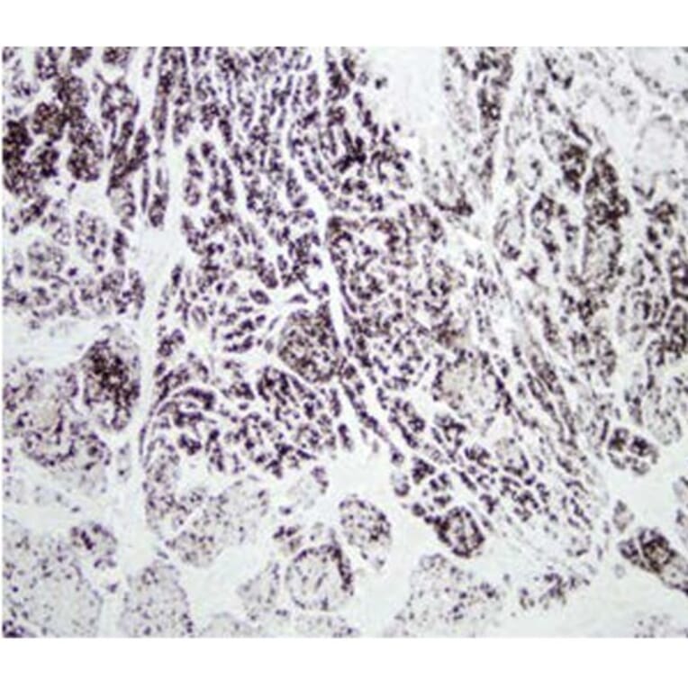 Validation Data - Anti-Chymotrypsin Antibody [CHY10-104.10] - BSA and Azide free (A304255)