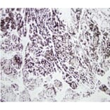 Validation Data - Anti-Chymotrypsin Antibody [CHY10-104.10] - BSA and Azide free (A304255)