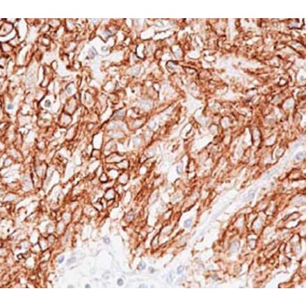 Validation Data - Anti-TMEM16A Antibody [DOG1.1] - BSA and Azide free (A304445)