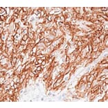 Validation Data - Anti-TMEM16A Antibody [DOG1.1] - BSA and Azide free (A304445)