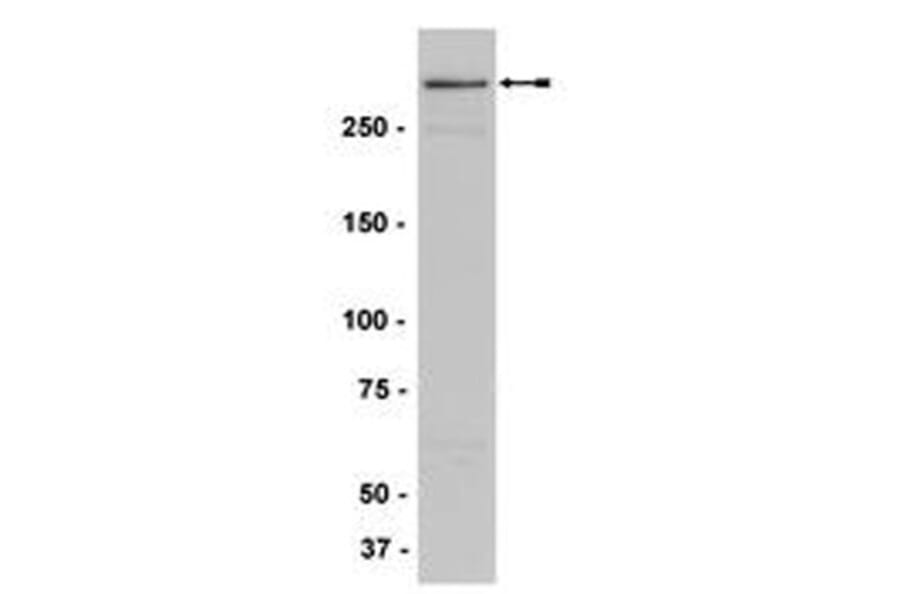 Validation Data - Anti-MLL.N Antibody [N4.4] - BSA and Azide free (A304446)