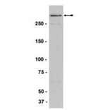 Validation Data - Anti-MLL.N Antibody [N4.4] - BSA and Azide free (A304446)