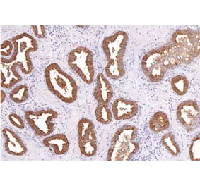 Validation Data - Anti-PSA Antibody [G654.1] (A304448)