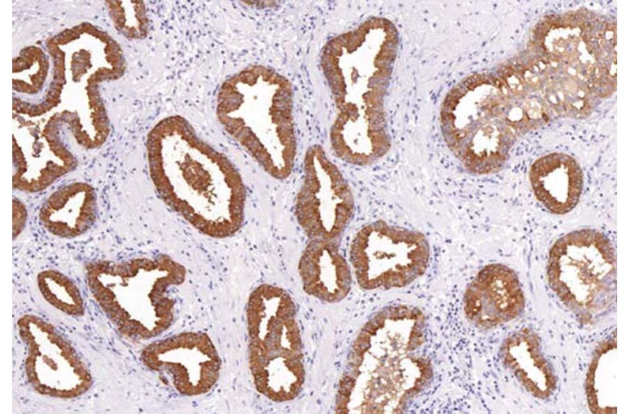Validation Data - Anti-PSA Antibody [G654.1] (A304448)