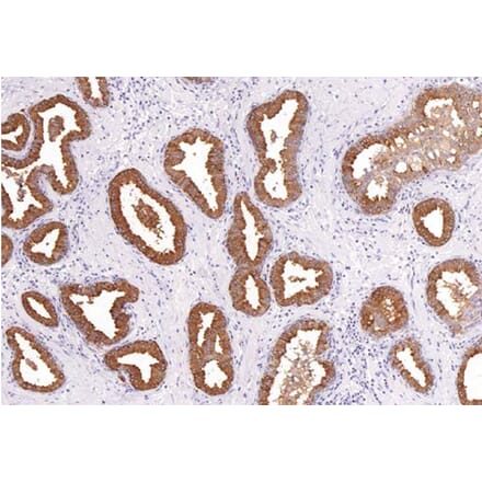 Validation Data - Anti-PSA Antibody [G654.1] (A304448)